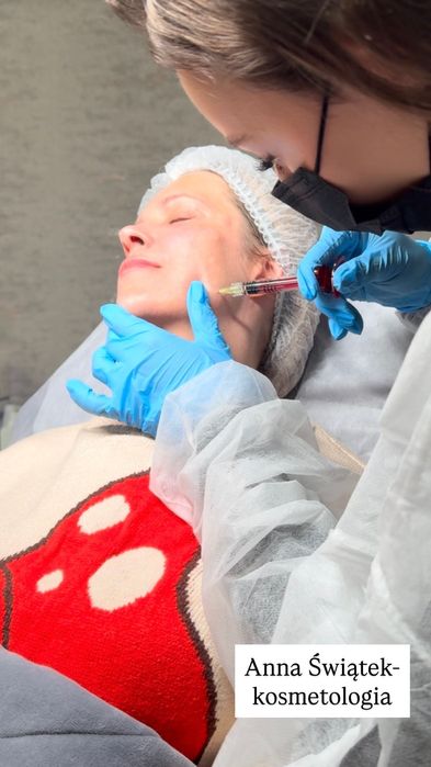 Kosmetolog | Stymulatory tkankowe,Mezoterapia igłowa, mikroigłowa