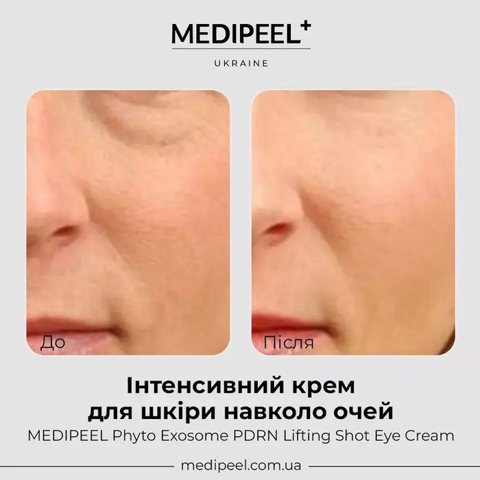 кожи вокруг глаз MEDIPEEL Phyto Exosome PDRN Lifting Shot Eye Cream