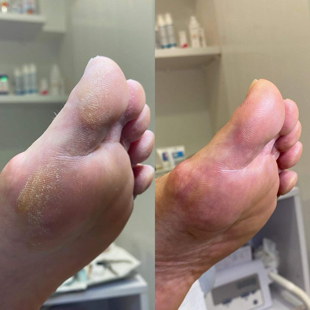Manicure i pedicure - dojazd do klienta