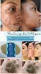 Peeling mar morto