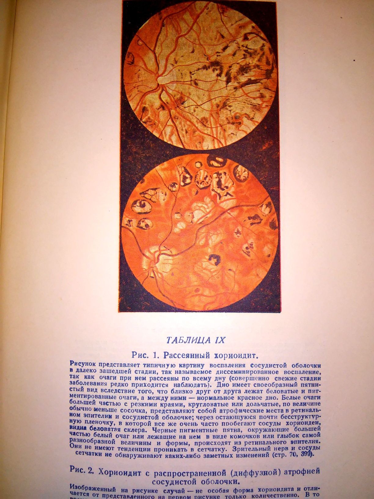 Аксенфельд Руководство по глазным болезням 2-е изд. 1939