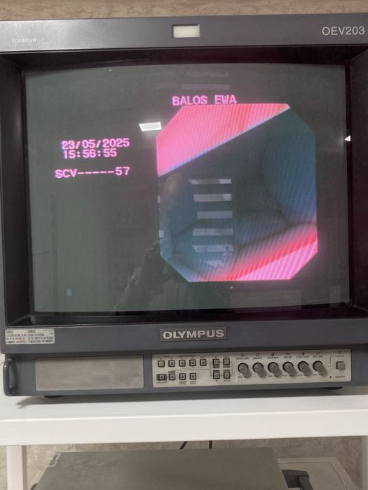 Ендоскоп гастроскоп стійка Олімпус