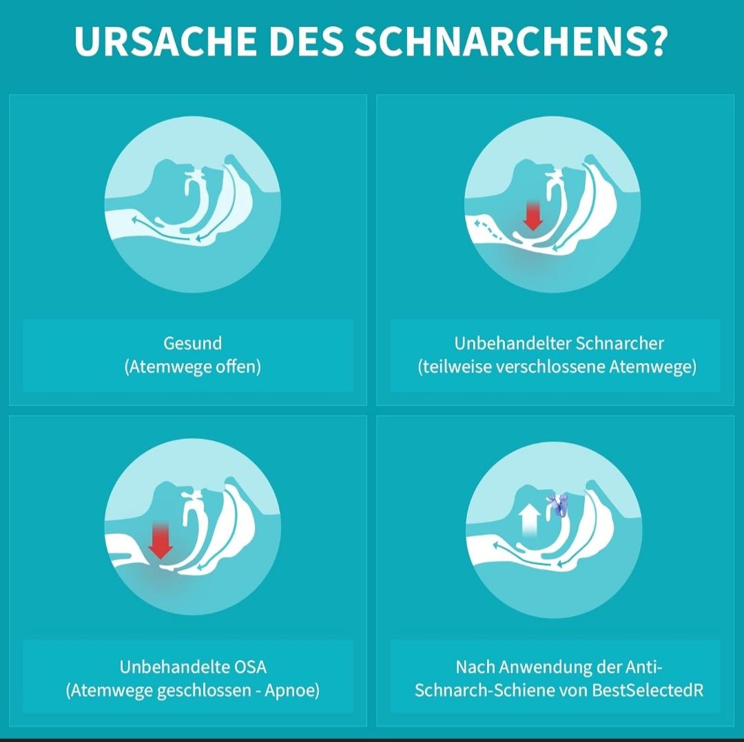 UrząUrządzenia przeciw chrapaniu  bestselec