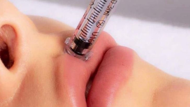 Caneta Pressurizada Intradermoterapia 2 em 1