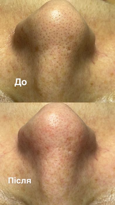 Послуги Косметолога