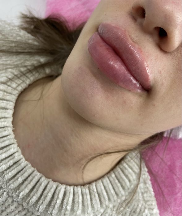 Аугментація обличчя