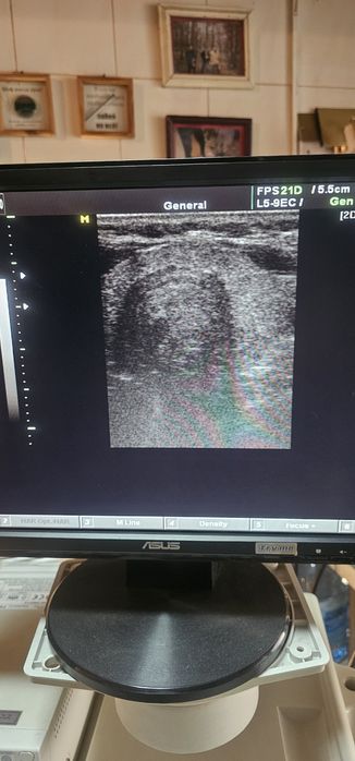 УЗД апарат SONOACE SA-8000 Livе