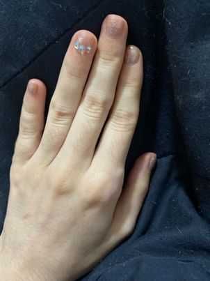 Unhas de gelinho