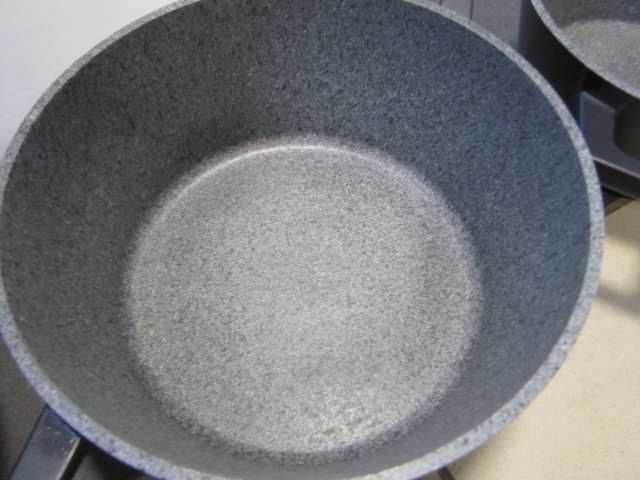 Komplet 3 garnków ZWIEGER  WHITE STONE