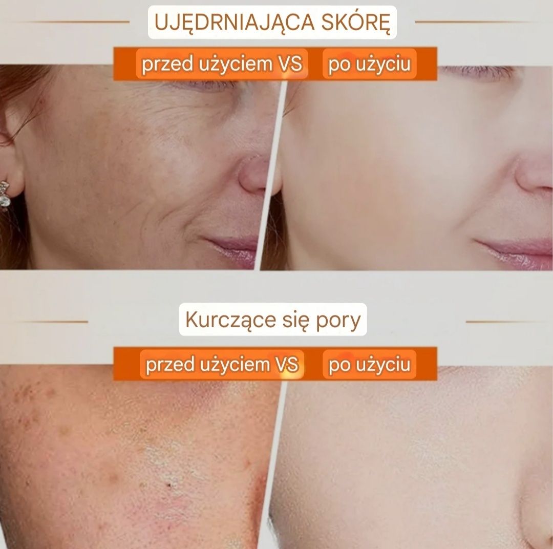 Wybielający krem z witaminą C, 3X Niacinamide+Retinol+Q10