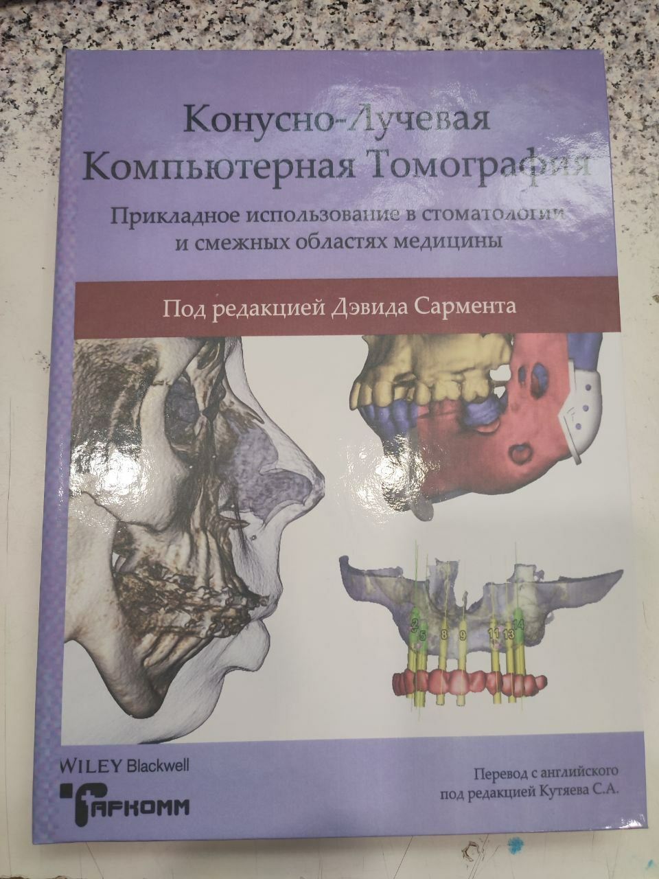 Конусно-лицевая компьютерная томография. Стоматология КТ гнатология