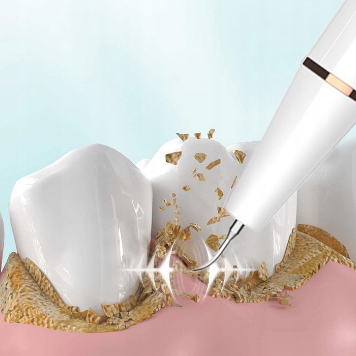 Ultradźwiękowy Środek Do Czyszczenia kamienia z Zębów