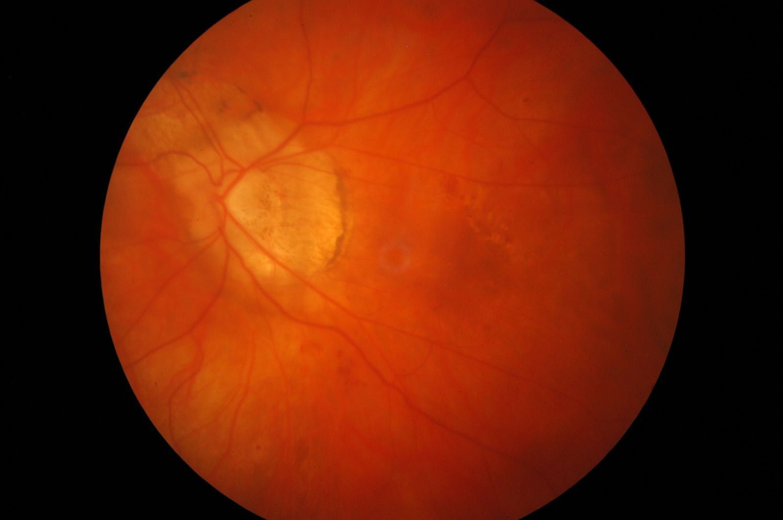 Retinografo kowa nonmyd 7