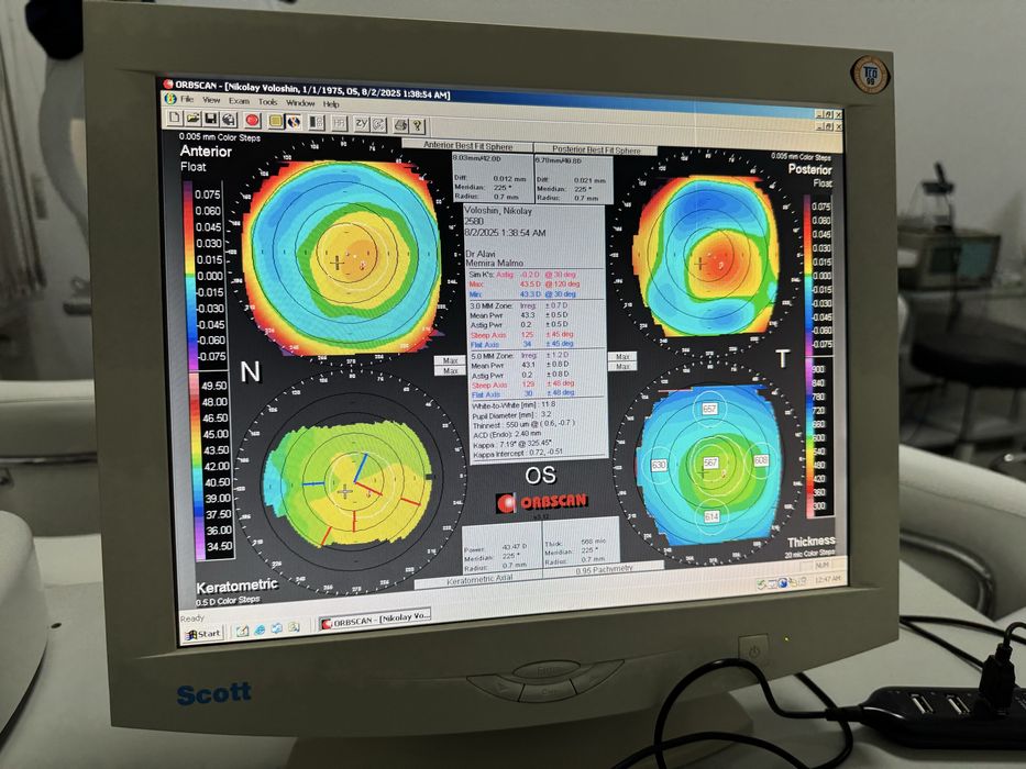 Кератотопограф Orbiscan II, повний комплект