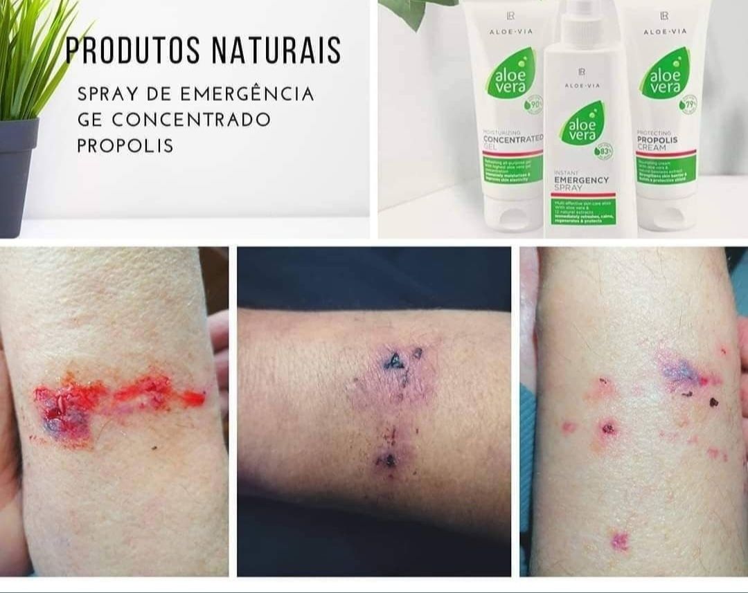 Box SOS Aloe Vera da LR nova e selada