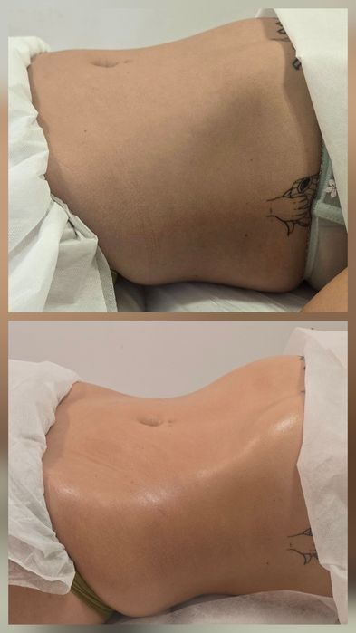 Masaż limfomodelujący – wybierz partię ciała, poczuj lekkość i relaks!