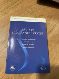 Żylaki i teleangiektazje przewodnik diagnostyczny