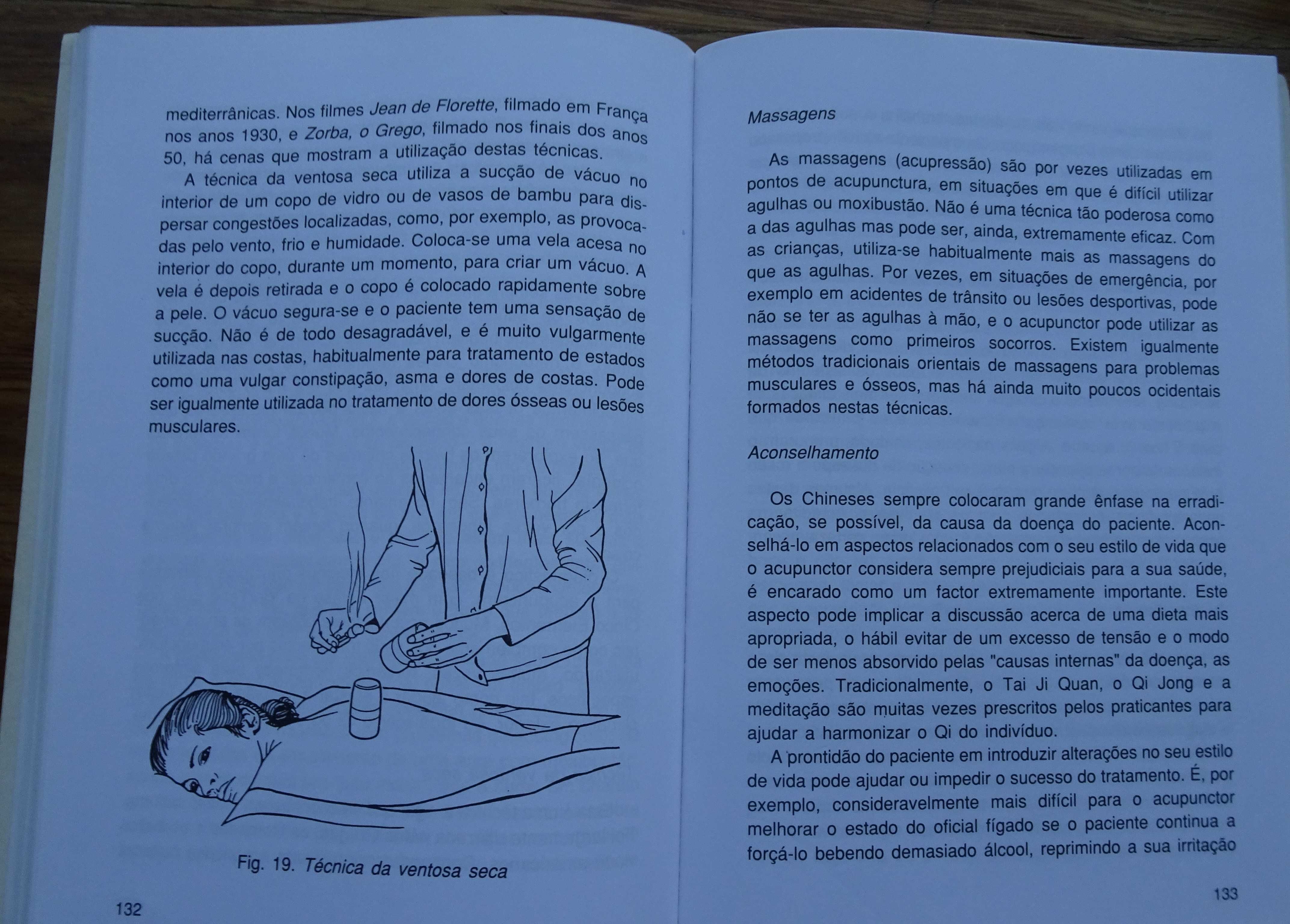 A  Acupunctura de Peter Mole