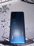 Xiaomi Redmi note 11s