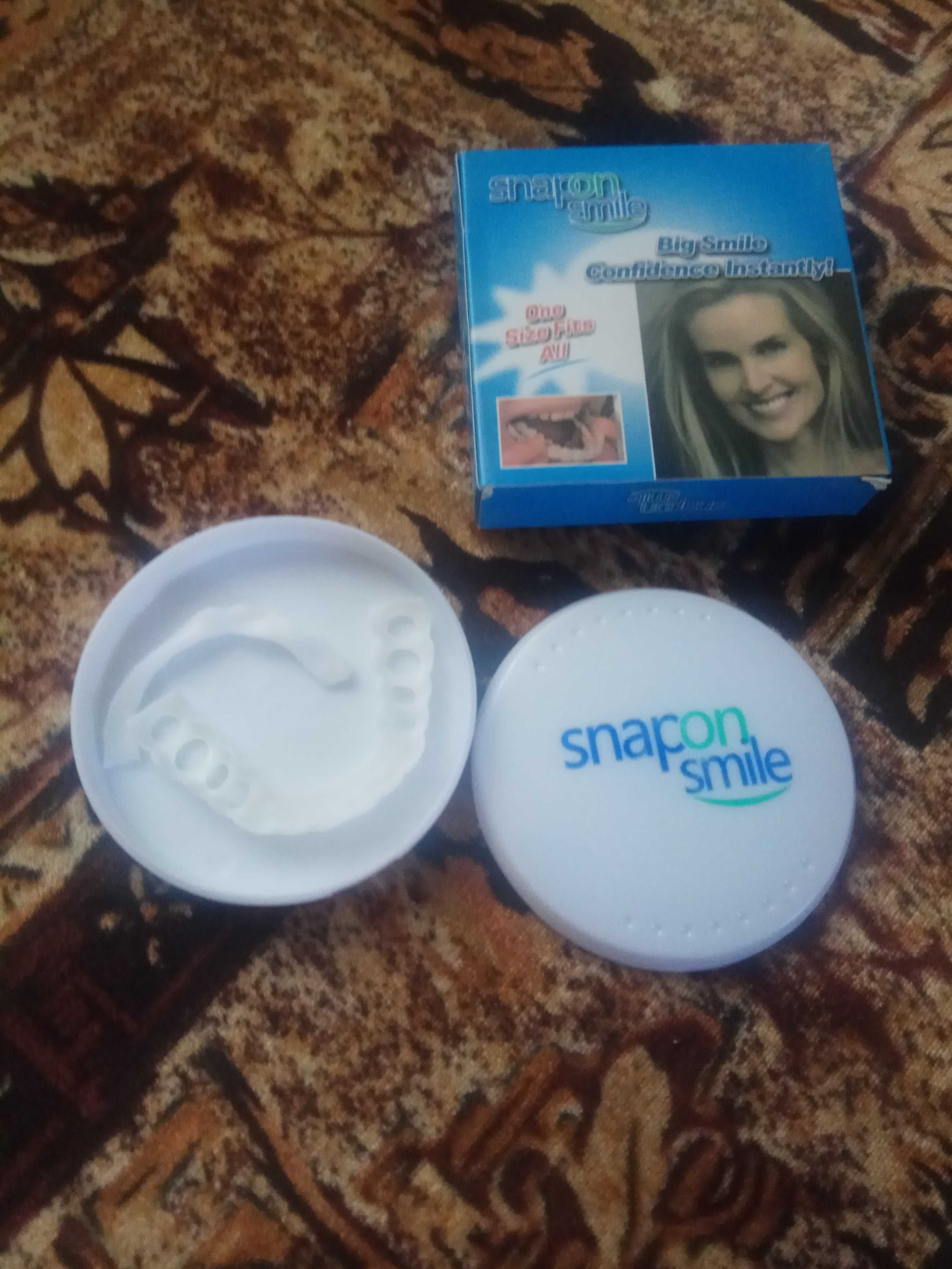 вініри на верхні зуби;perfect smile i snap on smile