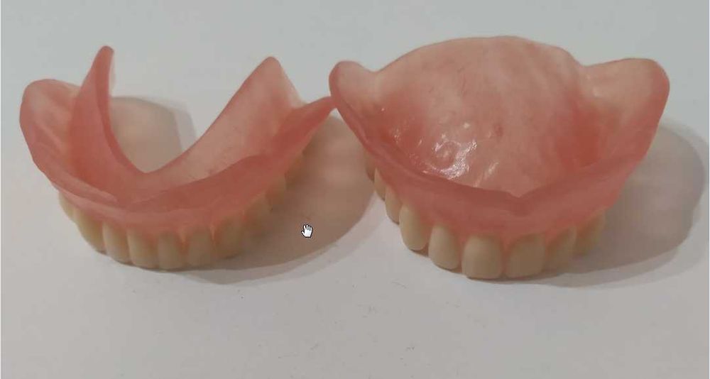 Зубний протез \акриловий\