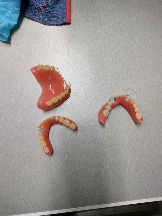 Ekspresowa Naprawa protez zębowych Opole centrum