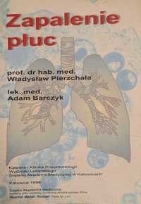 "Zapalenie płuc" prof. dr hab. med. Władysław Pierzchała