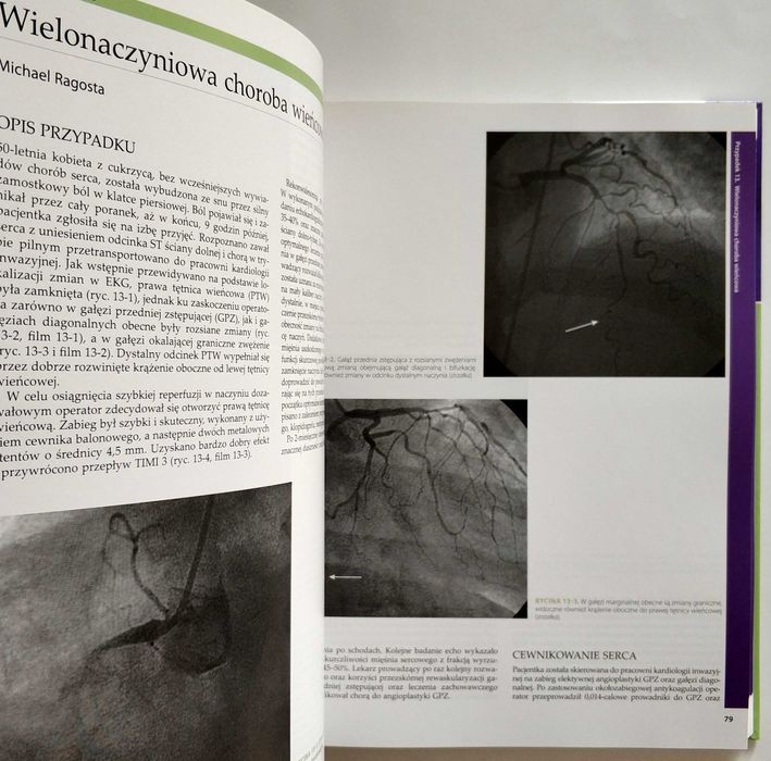 KARDIOLOGIA INTERWENCYJNA przypadki kliniczne, Michael Ragosta, NOWA!