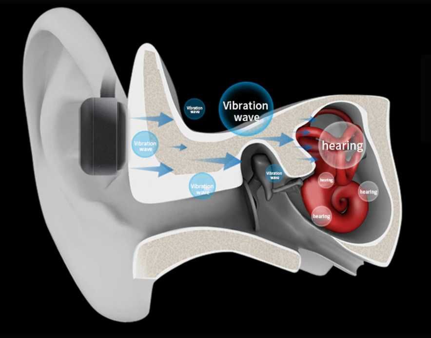 Słuchawki kostne wodoodporne 8GB pamięci wbudowanej!
