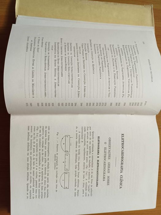 Eletrocardiografia Clínica - Scherf-Boyd