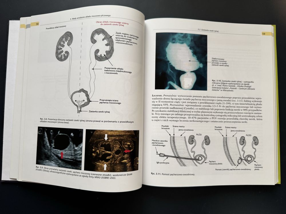 Urologia ilustrowany podręcznik dla studentów i stażystów Tomasz Drewa