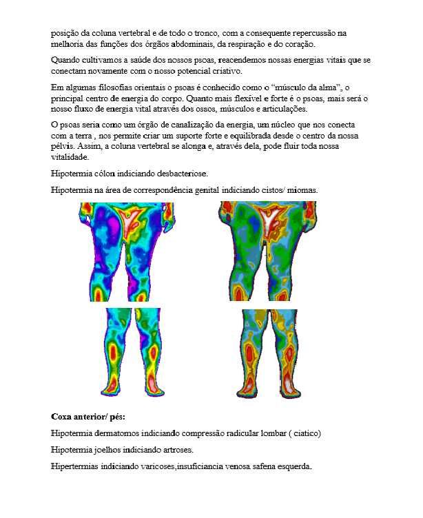 Seja Especialista em Termografia  e Transforme Sua Carreira na Saúde!