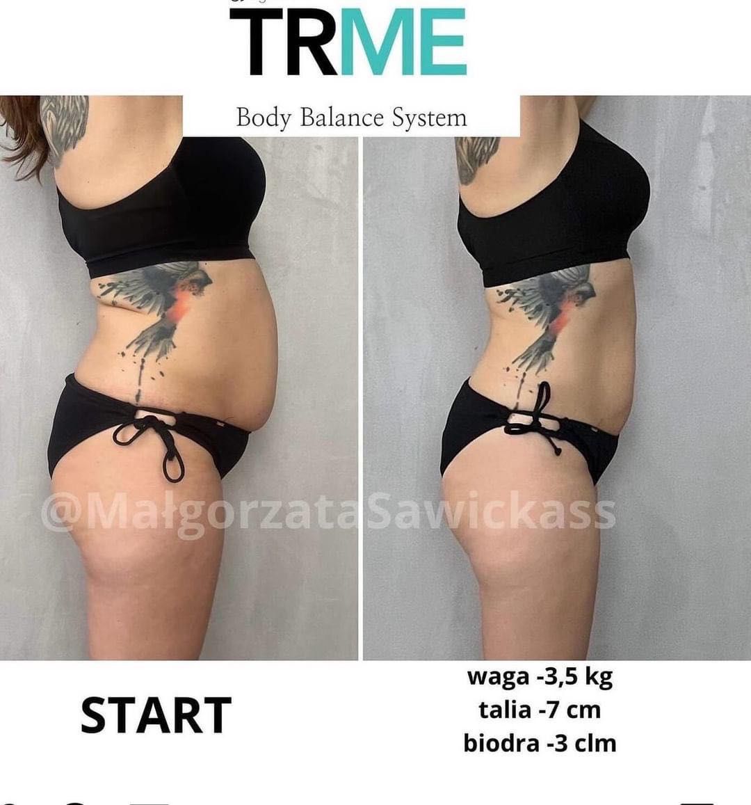 TRME Body Balance System suplementy wspomagające utratę masy ciała