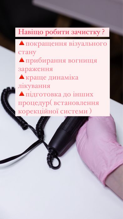 Подолог Харків, Центр. Подологічний педікюр