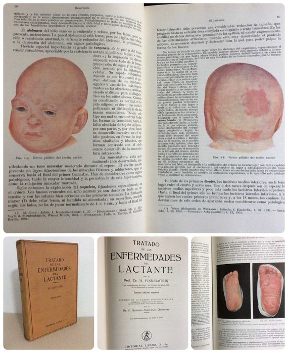 Tratado de las enfermedades del lactante. Por Finkelstein, H., 1941