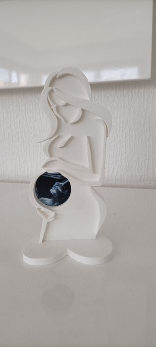 Moldura gravida ecografia