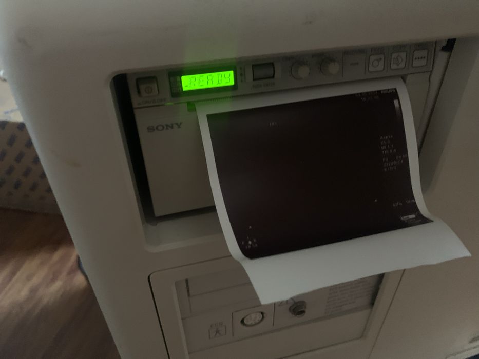 Прінтер  sony для апарата узд узи