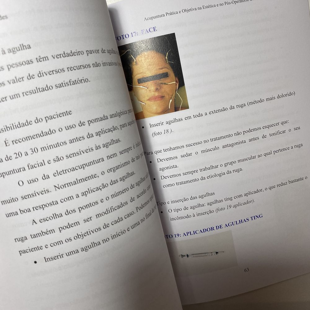 Livro "Acupuntura Prática e Objetiva na Estética", Fernando Fernandes