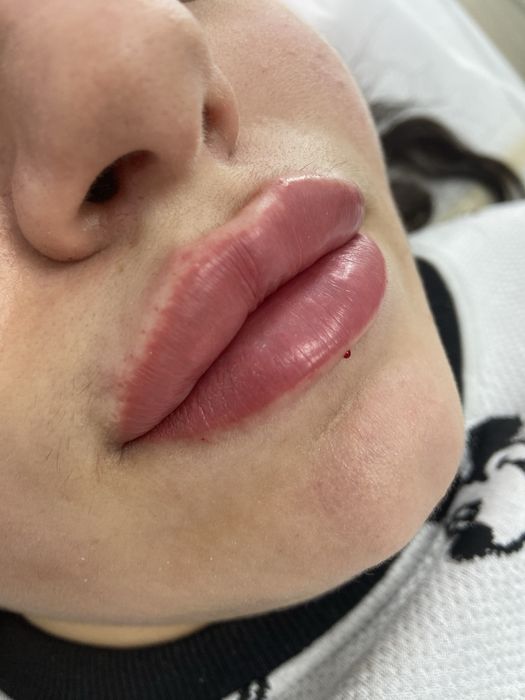 Аугментація обличчя