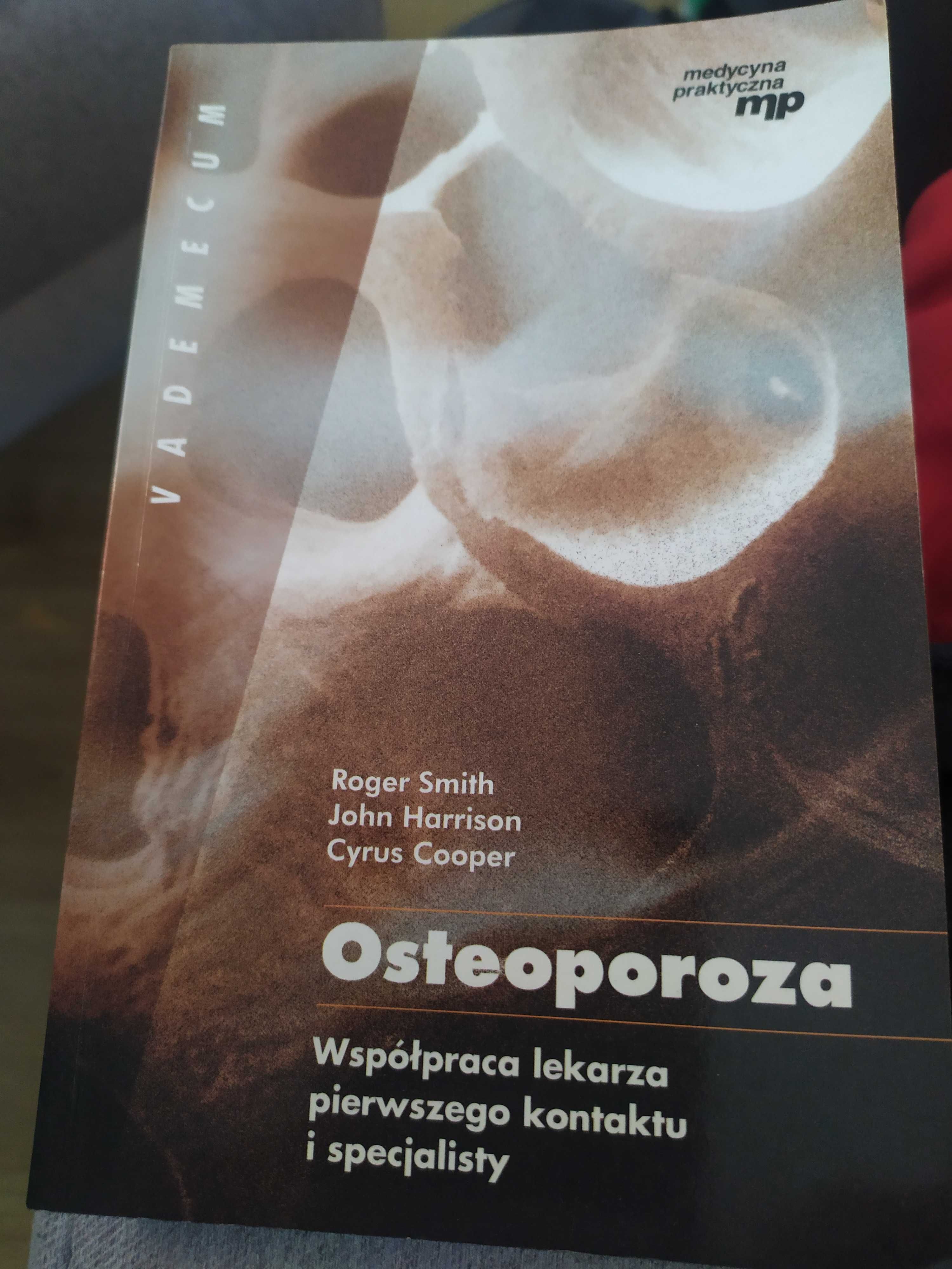 Osteoporoza vademecum