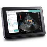 SonoSite iViz портативный карманный цветной сканер узи узд
