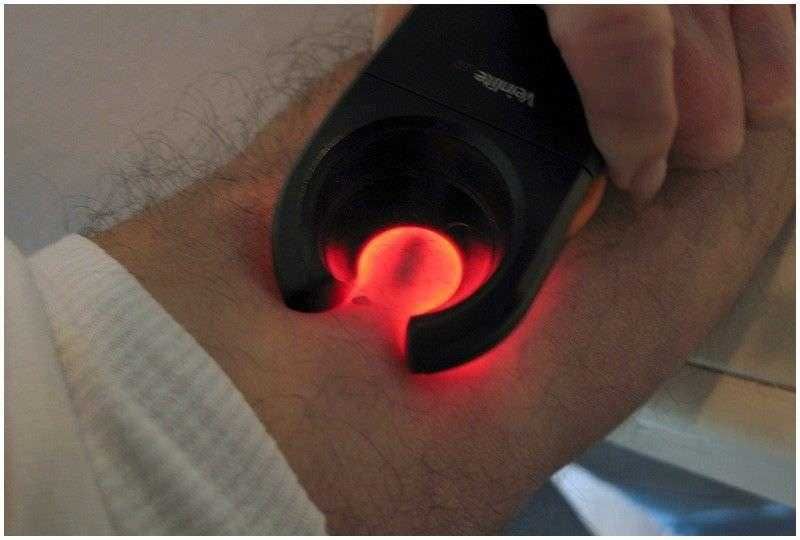 Венозний сканер Veinlite