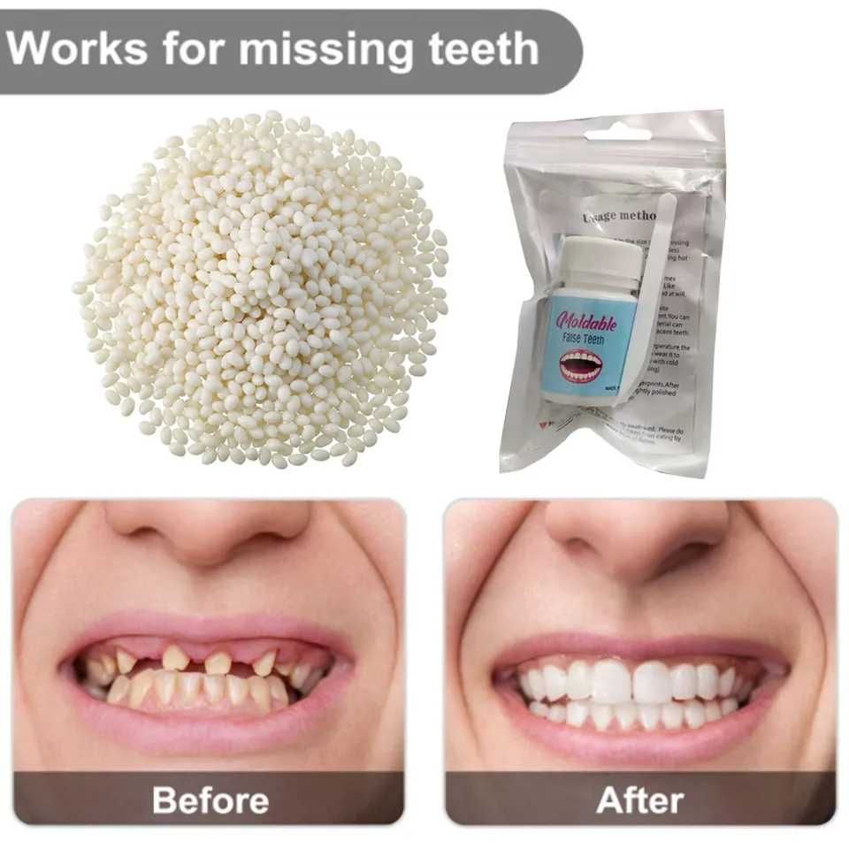 Клей гель для ремонта зубов. 25 грамм