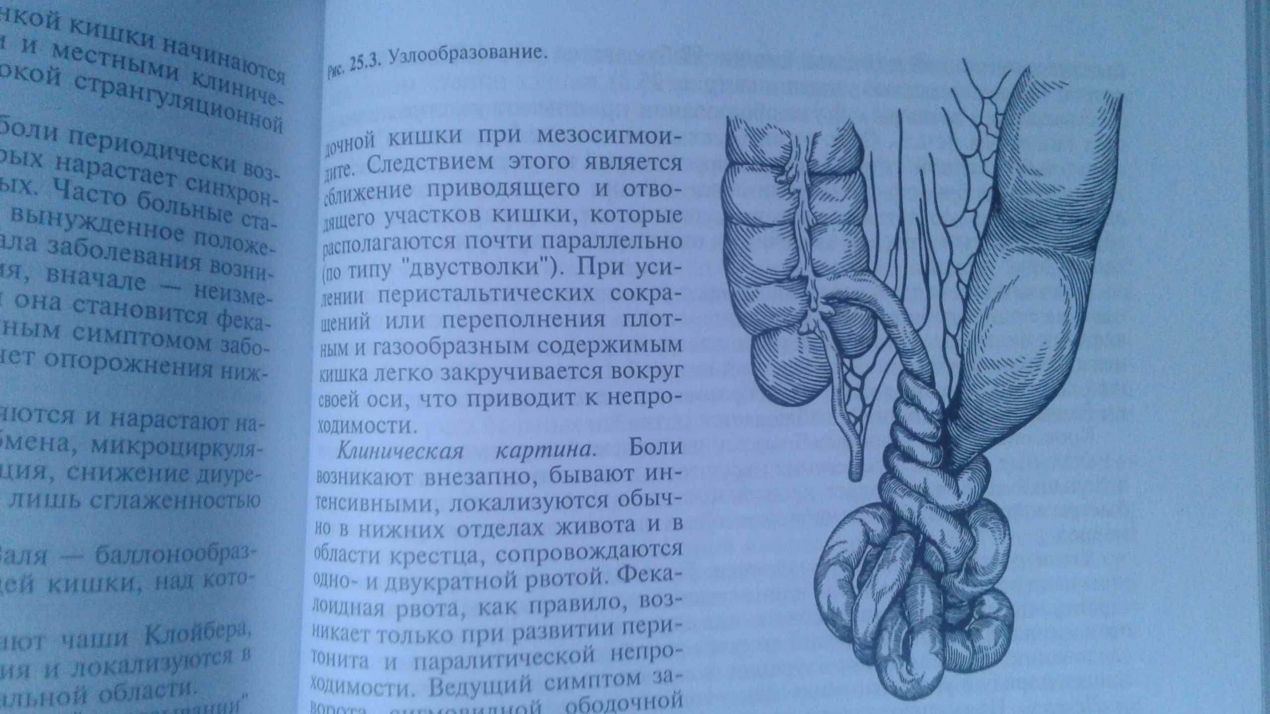 Хирургические болезни Кузин 2005 год учебник медуниверситетов