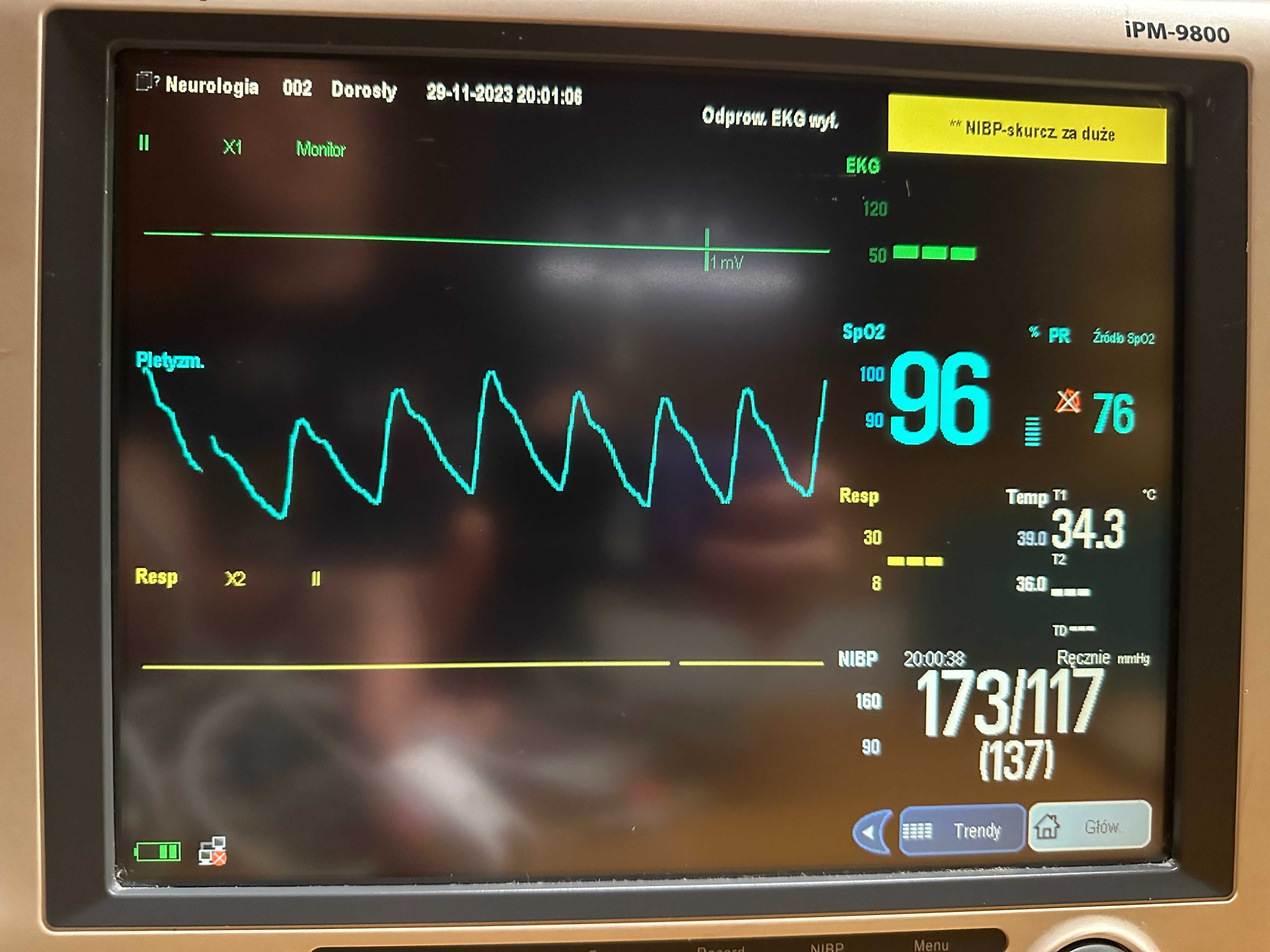Kardiomonitor Mindray IPM-9800 - 12 cali 100% sprawny