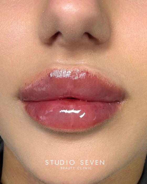 Powiekszanie ust, powiększanie ust