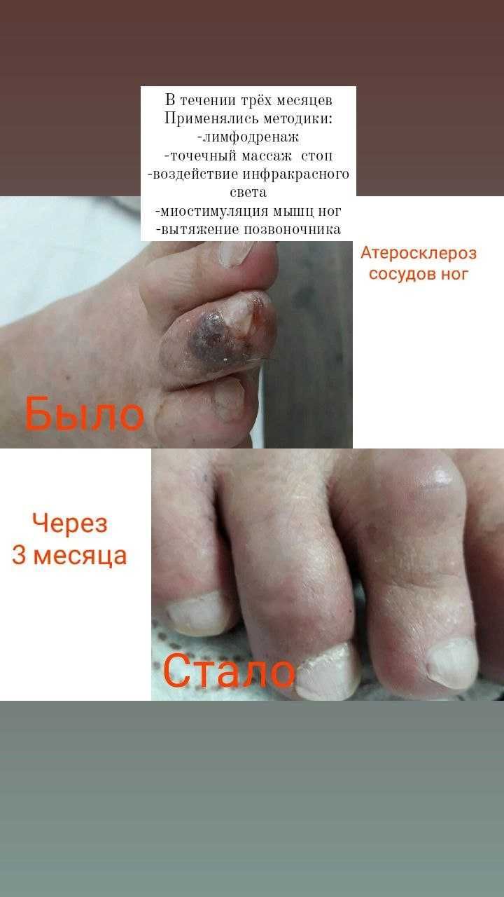 Масаж Запоріжжя|Біль у спині, суглобах|Витяжіння, корекція хребта