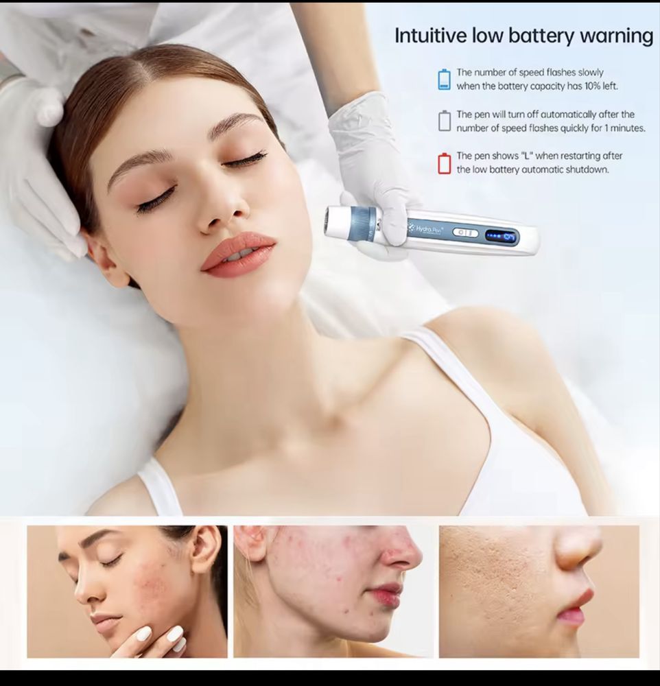 Оригинальная ручка H5 Hydra Derma
