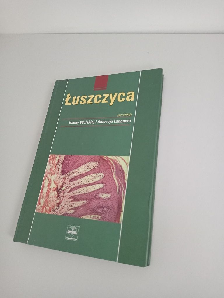 Łuszczyca podręcznik medyczny