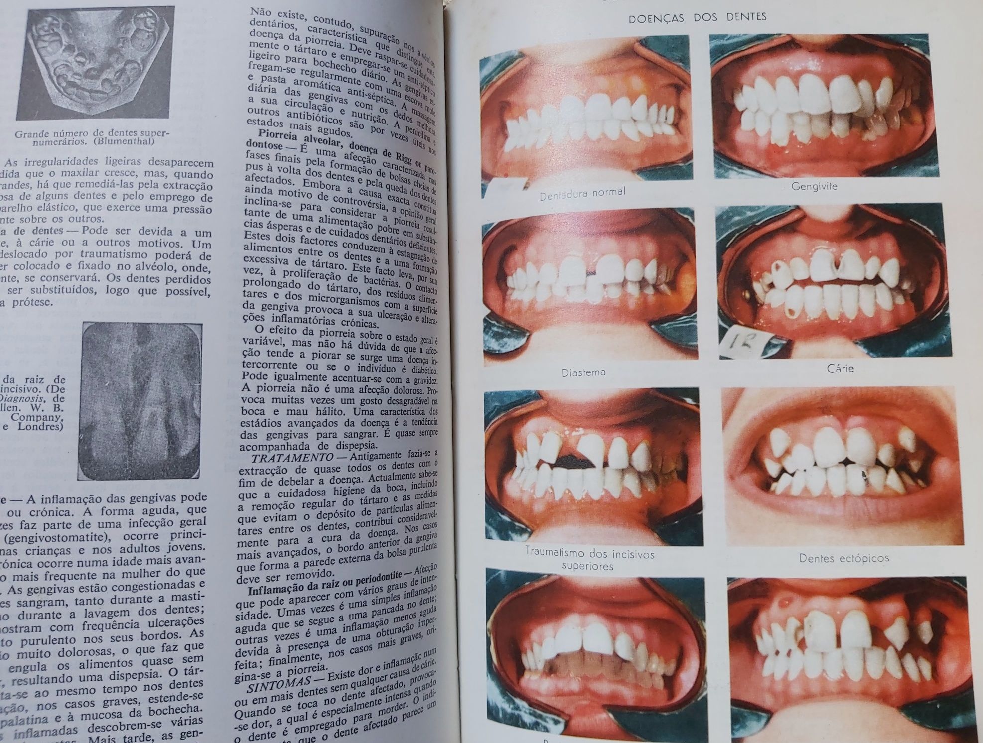 Dicionário enciclopédia médica 1977